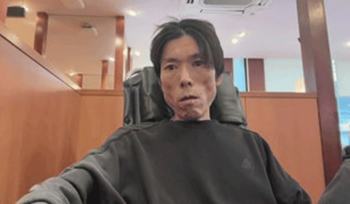 金バエは死亡した!死因は自殺?の噂や余命宣告されていた!?